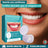 CARILLAS DENTALES SNAP ON DENTURE