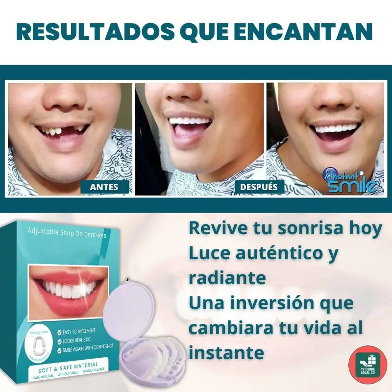 CARILLAS DENTALES SNAP ON DENTURE