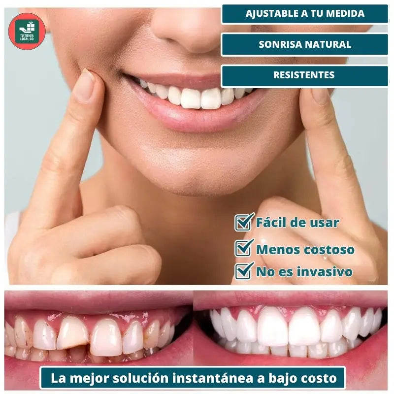 CARILLAS DENTALES SNAP ON DENTURE